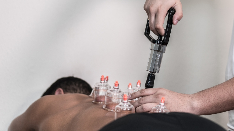 Does Cupping Therapy Help in Reducing Anxiety and Depression?